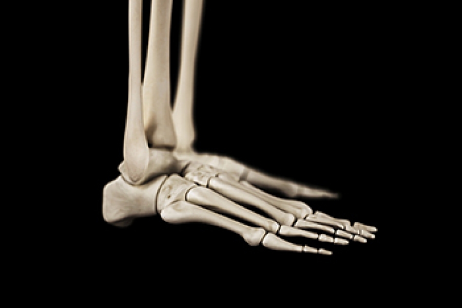 diagnosis-of-stress-fractures