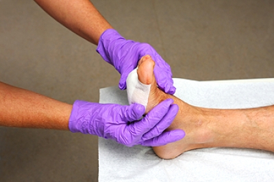 Effective Steps to Heal a Foot Wound